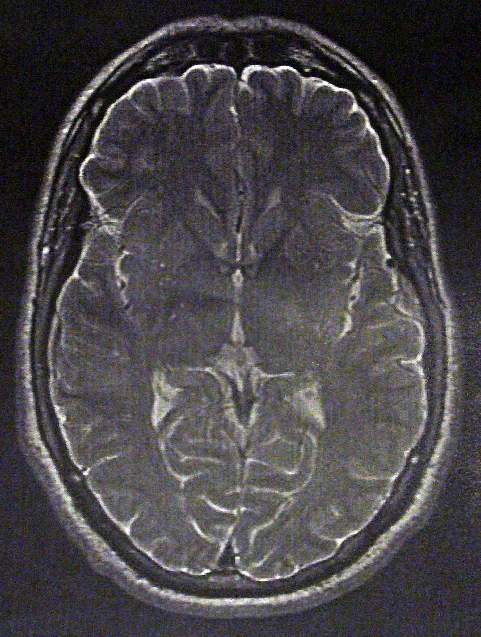 Pic: Proof brain - Andy Powell (Flickr)
